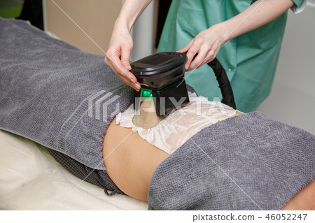Woman getting cryolipolysis fat treatment 46052247