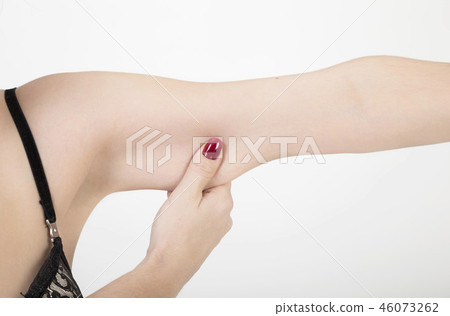 hand squeezing excess fat of her arm over white 46073262