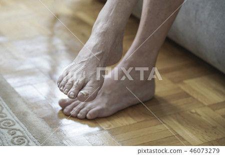 damaged nails because of fungus and athlete's foot damaged nails because of fungus and athlete's foot 46073279
