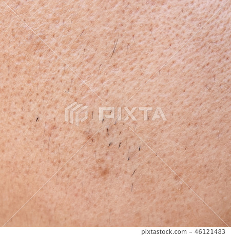 surface asian man face skin after do not take care 46121483