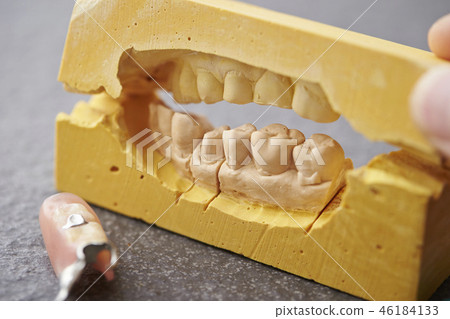 牙齒模型和局部義齒 牙齒模型和局部義齒 46184133