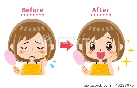 Freckle Simi Before After - Stock Illustration [46228079] - PIXTA