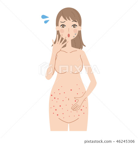 A pregnant woman with a rash A pregnant woman with a rash 46245306