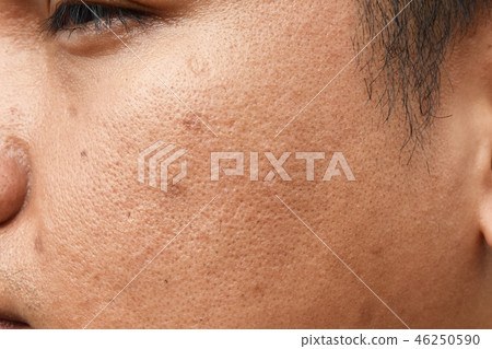 pores and oily on surface asian man face skin 46250590