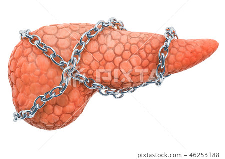 Pancreatic disease concept. Human pancreas Pancreatic disease concept. Human pancreas 46253188