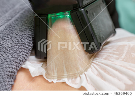 Woman getting cryolipolysis fat treatment Woman getting cryolipolysis fat treatment 46269460