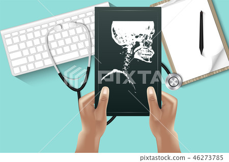 Doctor hands is holding X-Ray film for examining  46273785