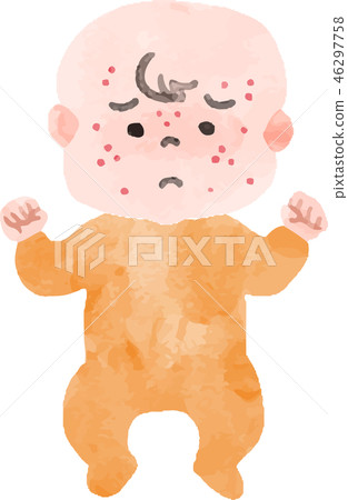 有皮疹的嬰兒 有皮疹的嬰兒 46297758