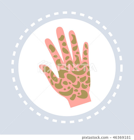 psoriasis shin disease human palm icon healthcare medical service logo medicine and health symbol psoriasis shin disease human palm icon healthcare medical service logo medicine and health symbol 46369181