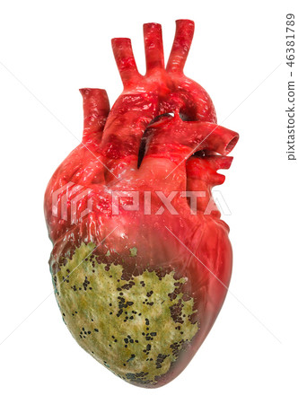 Heart disease concept, 3D rendering Heart disease concept, 3D rendering 46381789