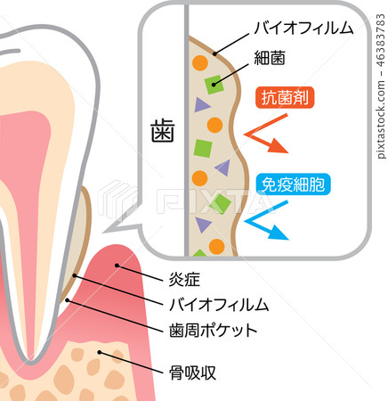 Biofilm teeth Biofilm teeth 46383783