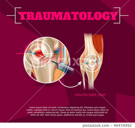 Realistic Illustration Traumatology Medicine in 3d 46434992