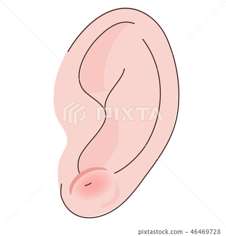 Ear piercing ear swelling swelling 46469728
