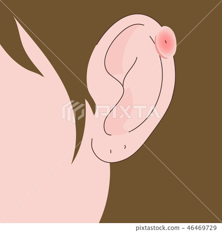 Ear piercing ear swelling swelling 46469729
