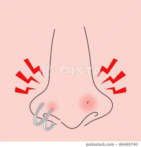 Pierced nasal suppuration swollen Pierced nasal suppuration swollen 46469740
