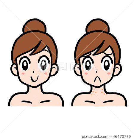 Female face normal and neck pops 46470779