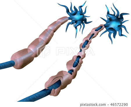 Multiple Sclerosis - Stock Illustration [46572290] - PIXTA