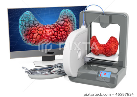 Creating artificial thyroid gland on 3D printer Creating artificial thyroid gland on 3D printer 46597654