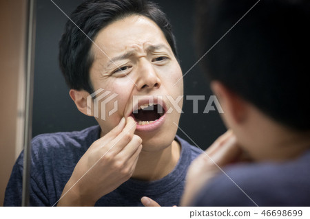 Young Japanese Male Stomatitis Looking at a Mirror Young Japanese Male Stomatitis Looking at a Mirror 46698699