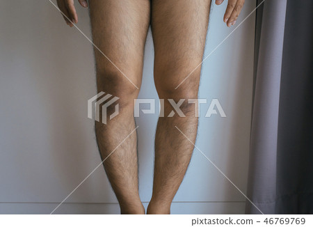 Asian man leg bandy-legged shape of the legs Asian man leg bandy-legged shape of the legs 46769769