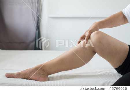 Scars on leg elderly woman with problematic Scars on leg elderly woman with problematic 46769916