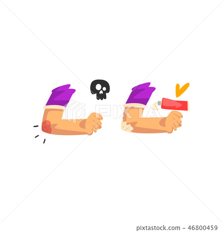 Elbow injury, first aid and treatment vector Illustration isolated on a white background 46800459