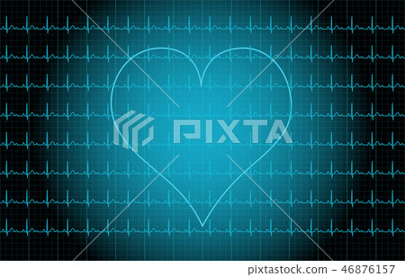 ECG image ECG image 46876157