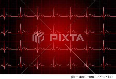 心電圖圖像 心電圖圖像 46876158