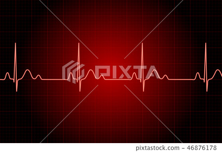 心電圖圖像 46876178