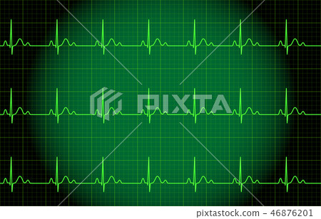 ECG image ECG image 46876201