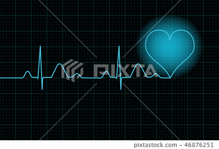 ECG image 46876251
