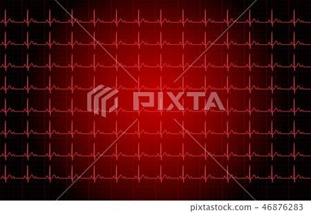 ECG image ECG image 46876283