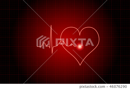 ECG image 46876290