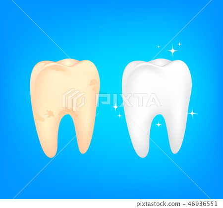 Dirty and clean tooth comparision on blue Dirty and clean tooth comparision on blue 46936551