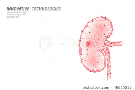 Human kidneys laser surgery operation low poly. Medicine disease drug treatment painful area. Red 46955852