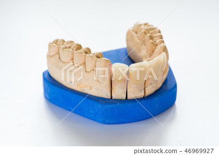 Dental gypsum model Dental gypsum model 46969927