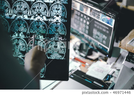 alzheimer's disease on MRI 46971446