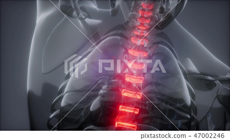 Hurt Spine. Male Backbone. Backache Hurt Spine. Male Backbone. Backache 47002246