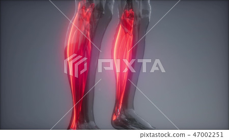 gastrocnemius- Visible muscle anatomy map 47002251