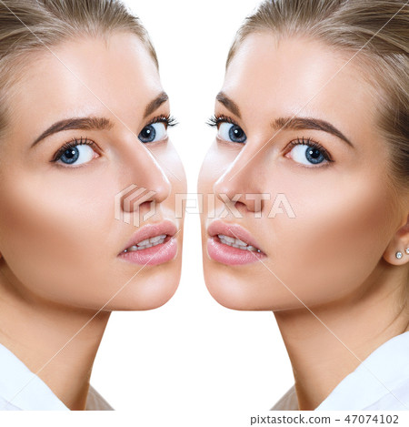 Female nose before and after cosmetic surgery. Female nose before and after cosmetic surgery. 47074102