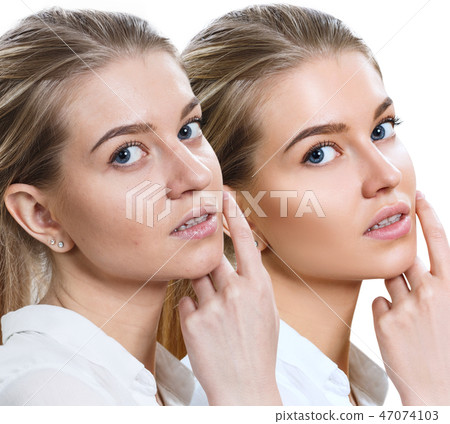 Comparison portrait of young woman before and after retouch. Comparison portrait of young woman before and after retouch. 47074103