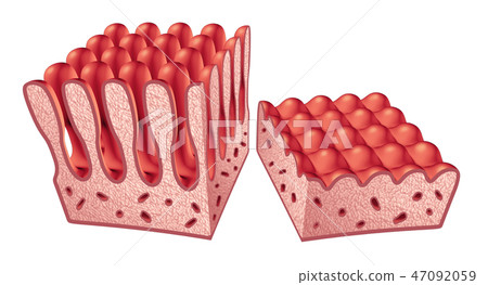 Celiac Disease Anatomy 47092059