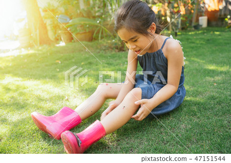 girl scratches her hand from a mosquito girl scratches her hand from a mosquito 47151544