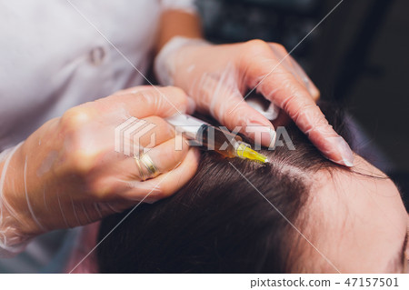 Platelet rich plasma injection procedure. Hair growth stimulation. PRP therapy process. 47157501