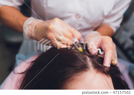 Platelet rich plasma injection procedure. Hair growth stimulation. PRP therapy process. Platelet rich plasma injection procedure. Hair growth stimulation. PRP therapy process. 47157502