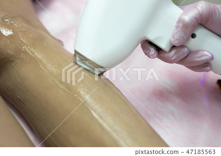 Laser epilation and cosmetology. Laser hair removal cosmetology procedure. Laser epilation and cosmetology. Laser hair removal cosmetology procedure. 47185563