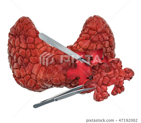 Thyroid surgery concept, 3D rendering Thyroid surgery concept, 3D rendering 47192002