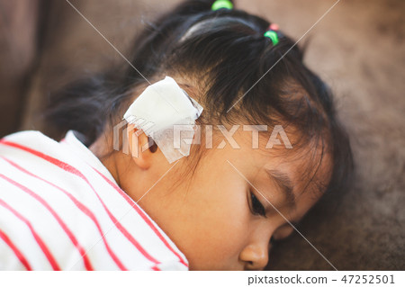 Asian child girl injured on the ear 47252501