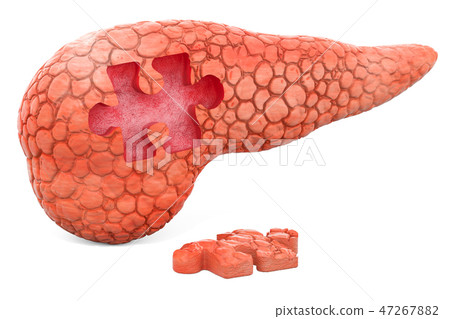 Pancreatic disease, medical concept, 3D rendering 47267882