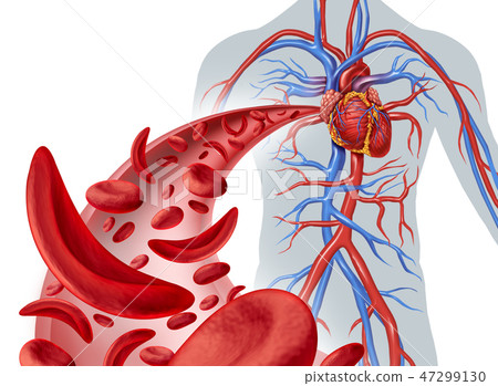 Sickle Cell Heart Circulation Sickle Cell Heart Circulation 47299130